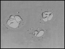 A sketch - the IVF unit's printer was broken